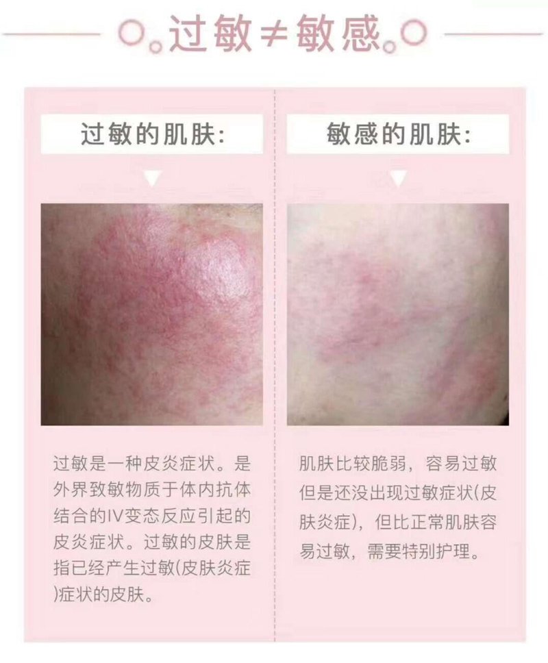 敏感肌修复