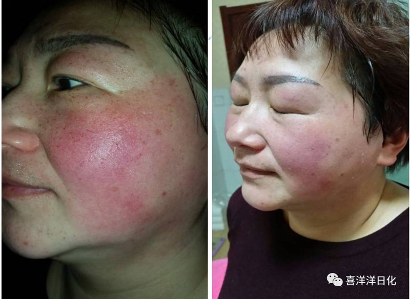承美之话：从批发零售逻辑看国货护肤品牌的渠道突围路径